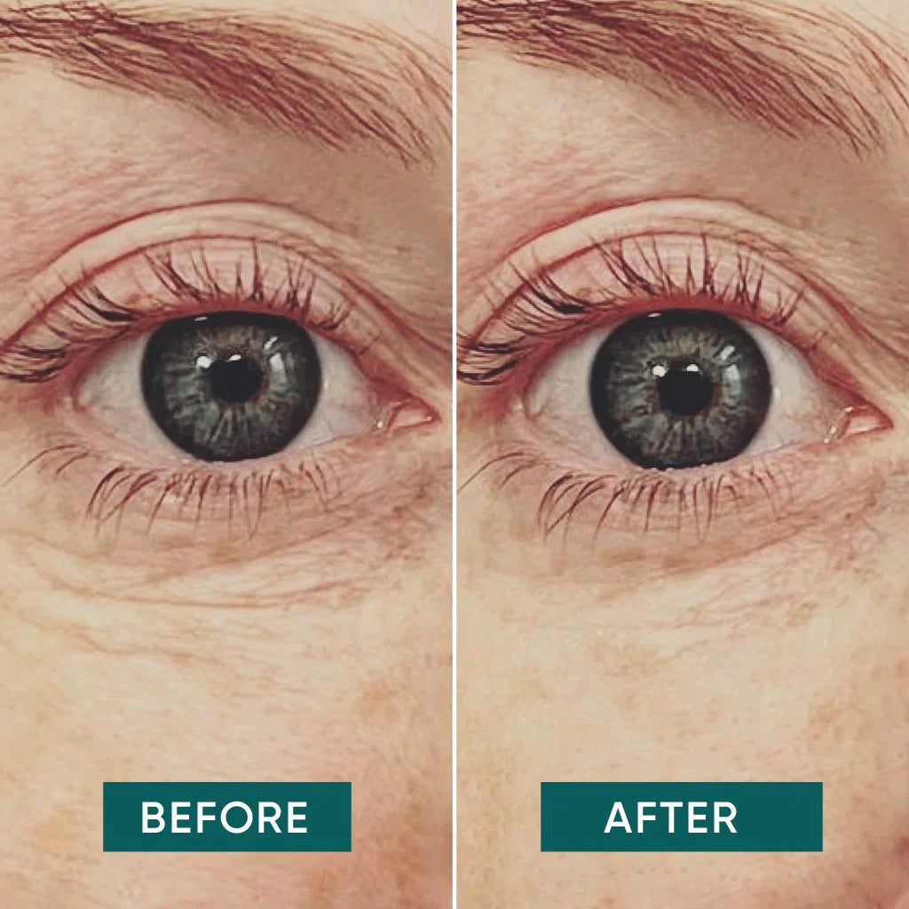 APRICOT I Augen Pads „Glow Getter“ mit Vitamin C – 30 Behandlungen